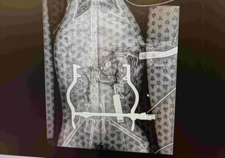 SUB Device for Cats with Ureteral Obstruction