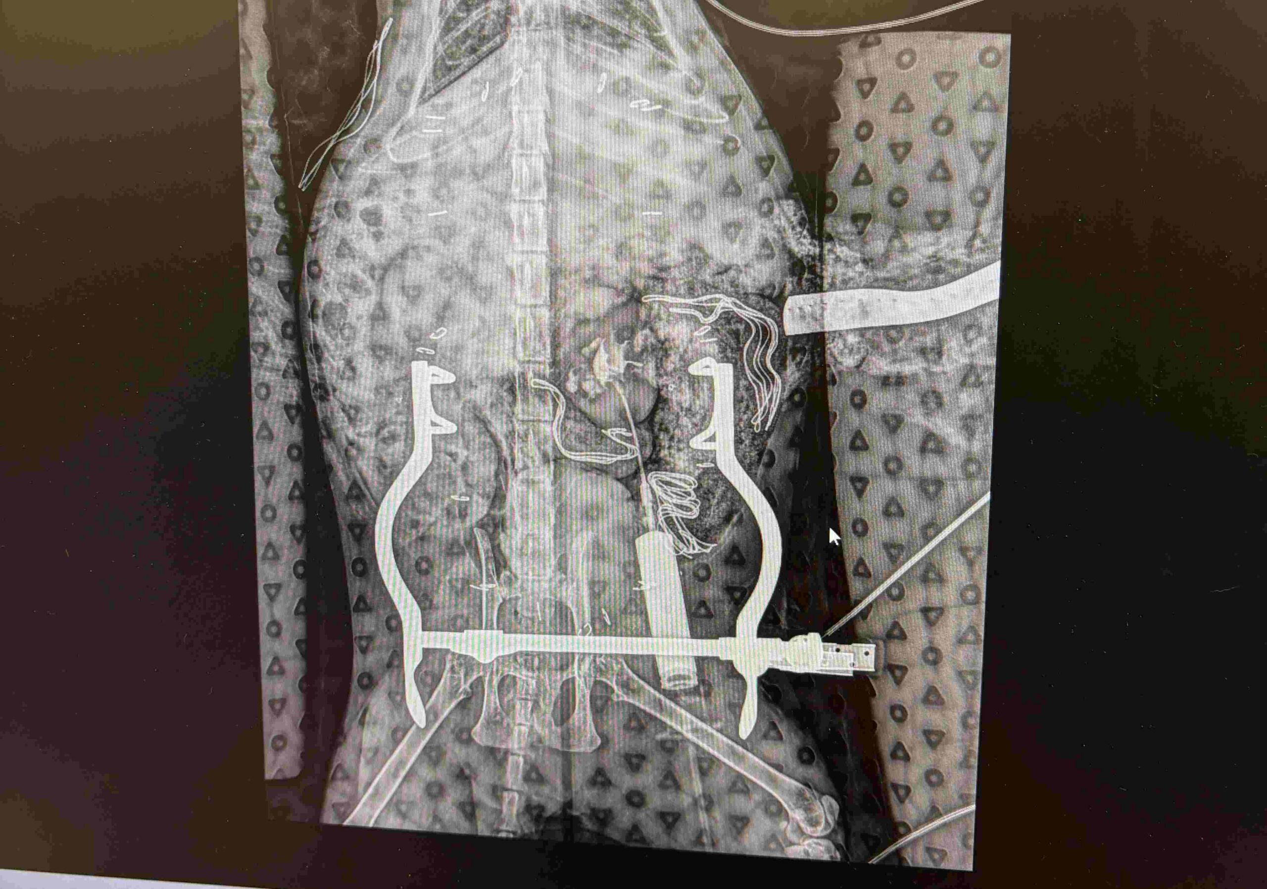 SUB Device for Cats with Ureteral Obstruction